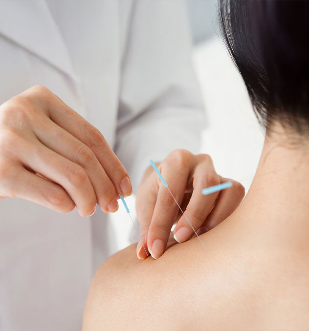 Acupuntura Formação e Pós-Graduação