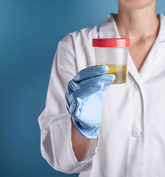 Análise e Interpretação de Exames em Urinálise